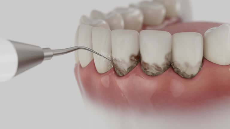 Reliable Dental contractor in Vinton, VA by Dentist Open Now